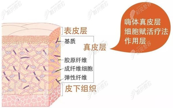 李杰医生在嗨体去颈纹方面的优势 李杰医生在嗨体去颈纹方面的优势