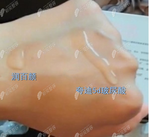 夸迪玻尿酸比润百颜扩散的快