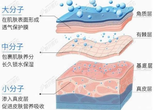 玻尿酸大中小分子填充原理