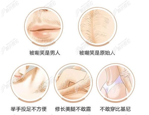 激光脱毛的原因