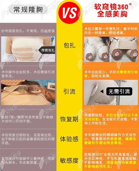 软窥镜隆胸和常规隆胸区别
