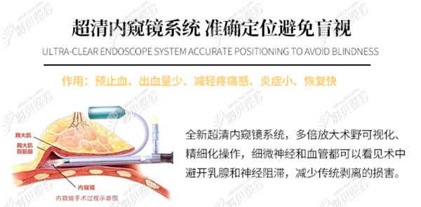 深圳曹孟君内窥镜隆胸优势