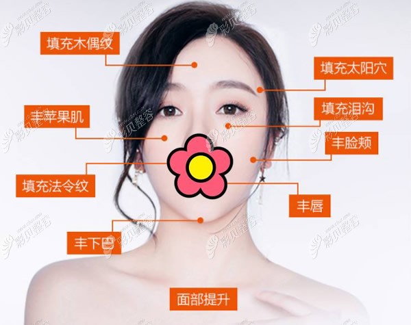 葡聚多肽适合填充哪些部位