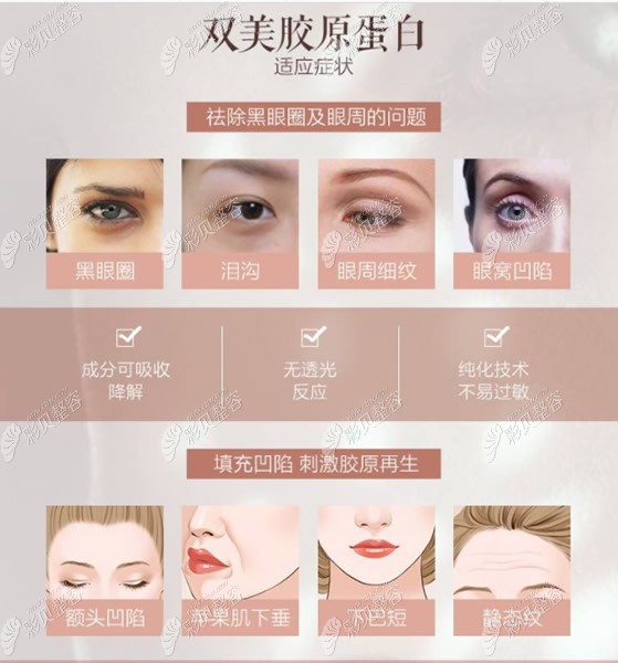 双美胶原蛋白适合填充的部位