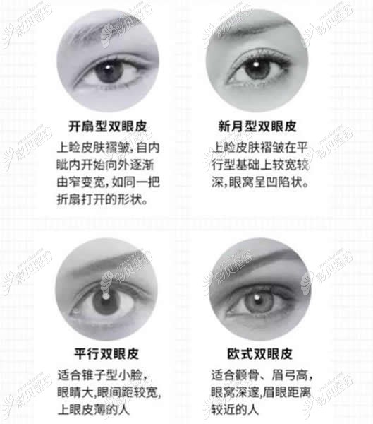 不同的眼睛适合的手术类型方式