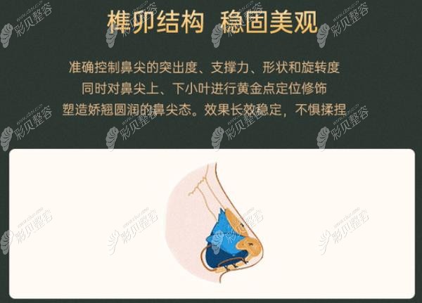 榫卯结构做鼻子的优势