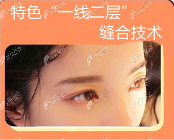 一线二层缝合技术