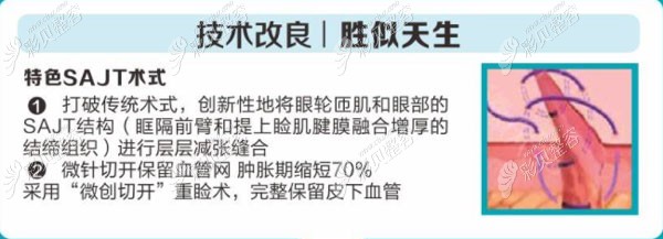 刘晋元拉双眼皮技术改良 刘晋元拉双眼皮技术改良