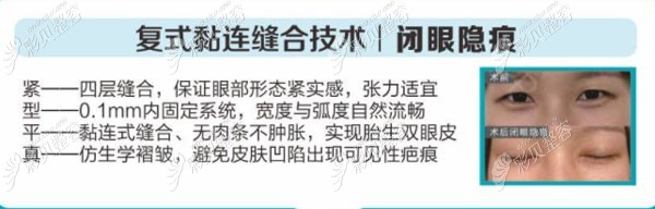 闭眼隐痕的原因 闭眼隐痕的原因