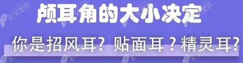 你是招风耳还是贴面耳 你是招风耳还是贴面耳