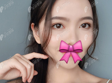 兰州崔大夫师芸红割双眼皮