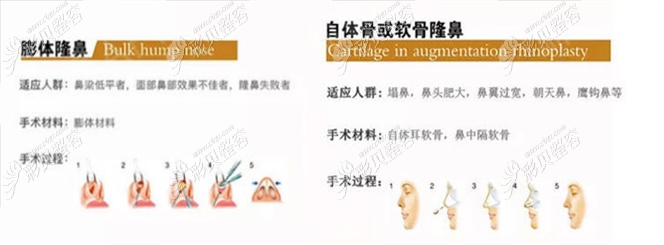 厦门欣医美李攀医生隆鼻