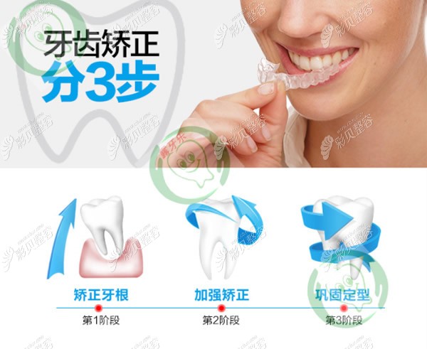 牙齿矫正的过程和步骤