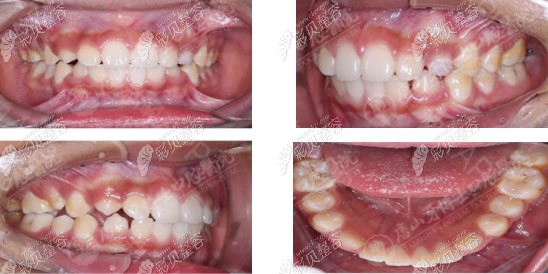 唐山牙博士口腔隐形正畸怎么样