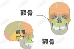 多图看懂颧弓内推和颧骨降低的区别,避免磨骨后脸还是很宽