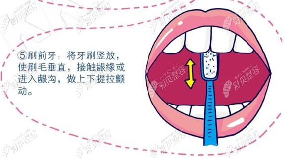 巴氏刷牙法步骤