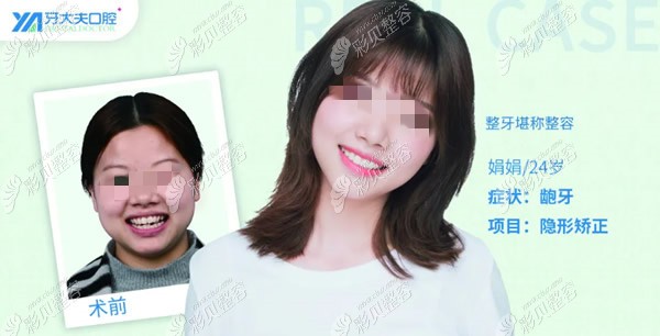 长沙牙大夫口腔周权医生正畸怎么样