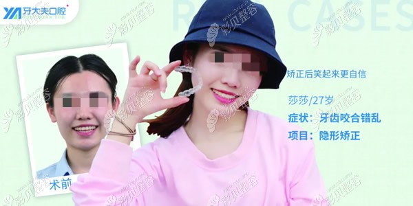 长沙牙大夫口腔周权医生隐适美极速版隐形矫正前后对比