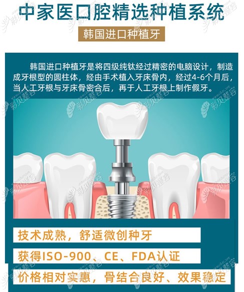 广州中家医家庭医生口腔韩国进口种植体优势