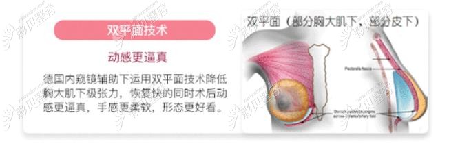 南京华美隆胸怎么样？双平面技术加持哦