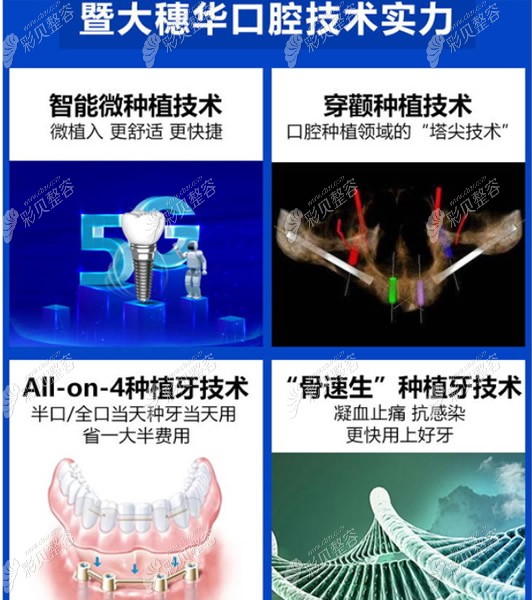 广州穗华口腔种植牙技术怎么样