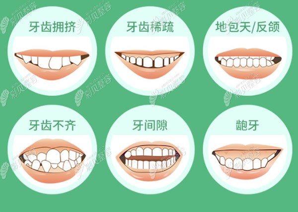 哪些牙齿需要矫正