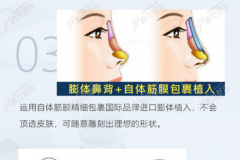 深圳美莱医院做鼻子好吗？医院内哪个医生做鼻子技术好？