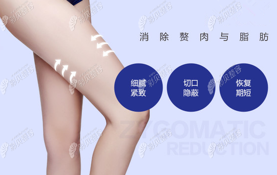 北京圣嘉新大腿吸脂宣传图