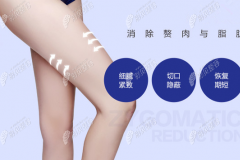 北京杨佳琦做大腿环吸不错,术后一个半月皮肤没有凹凸不平