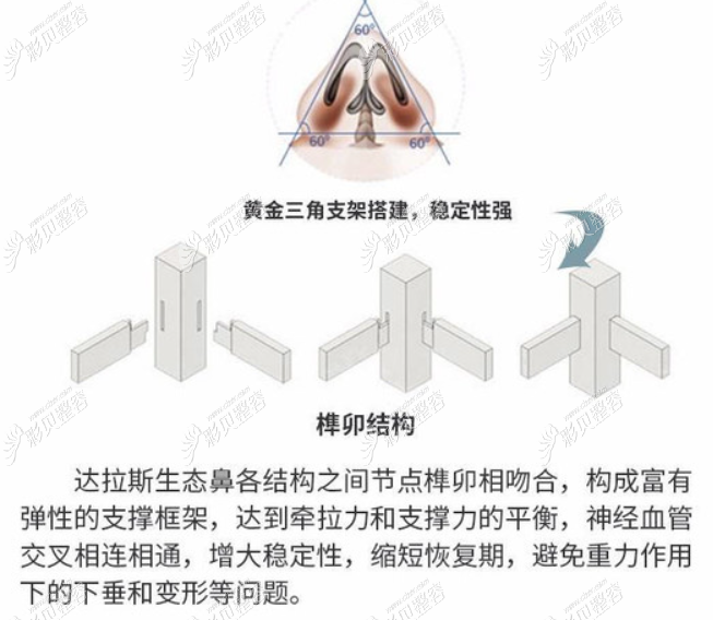 西安美莱整形做鼻综合怎么样 榫卯结构示意图 西安美莱整形做鼻综合怎么样 榫卯结构示意图