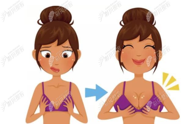 南京假体隆胸口碑好的医生有仝润泽