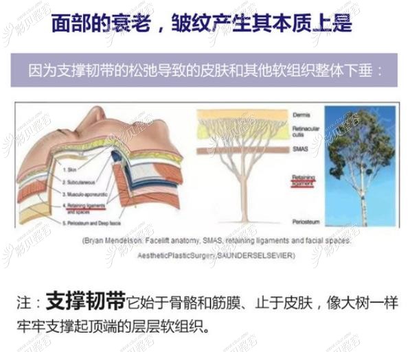 柳民熙3D童颜术原理