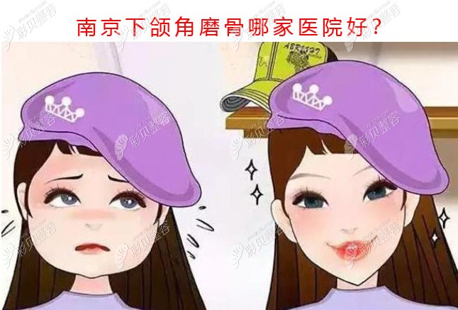 南京做下颌角磨骨哪家医院好,我想找有四级资质的整形医院