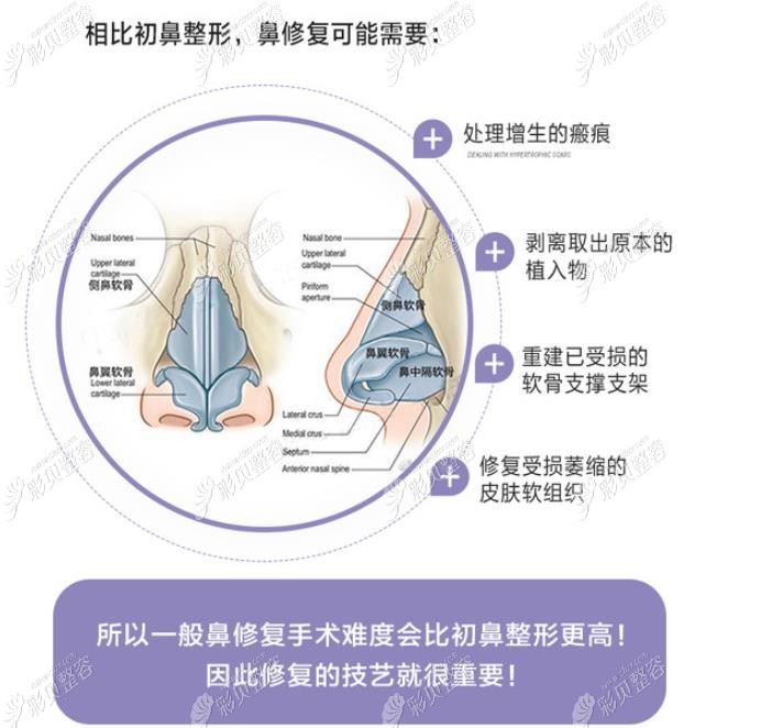 杭州时光胡斌医生做鼻子风格多变,那他做鼻综合修复怎么样