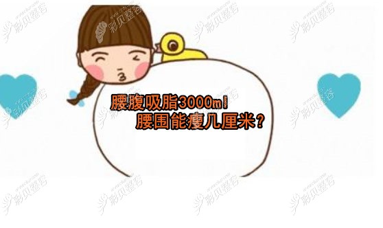 腰腹吸脂3000cc腰围能瘦几厘米