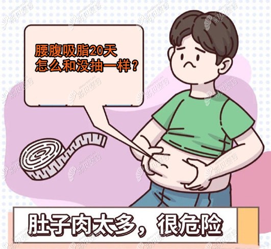 腰腹吸脂20天感觉和没抽一样,我抽了3000ml肚子为啥还鼓鼓的?