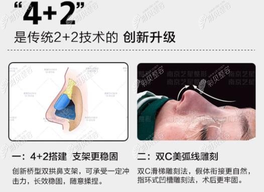 南京艺星肋骨鼻综合优势
