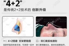 南京艺星做鼻子怎样,看隆鼻医生名单及肋骨鼻综合修复价格