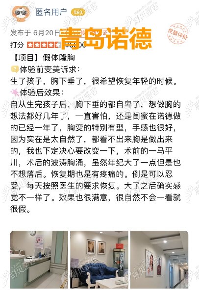 青岛诺德整形医院假体隆胸怎么样