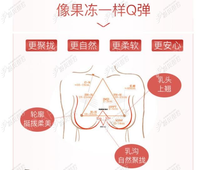杭州艺星万连壮隆胸技术优势
