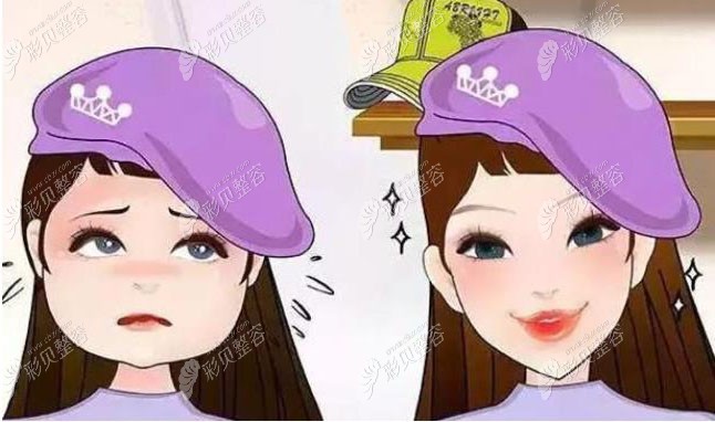 轮廓面部固定做什么_面部轮廓整形术_面部轮廓固定怎么做