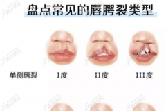 中国哪家医院做唇腭裂手术好被推荐的多？附医保报销比例
