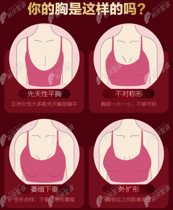 南宁华美哪个医生假体隆胸做得好?想了解赵广生做胸怎么样