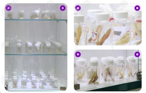 徐威强医生面部截骨部分标本