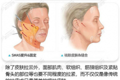 南京做面部拉皮手术比较好的医院中,我推荐施尔美整形医院