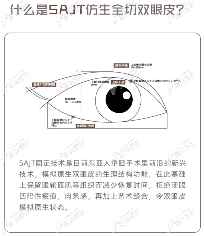 西安亚太做双眼皮手术多少钱