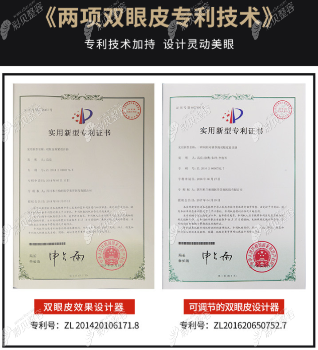西安米兰柏羽割双眼皮怎么样