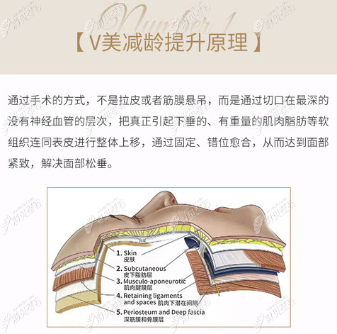 北京加减美面部提升