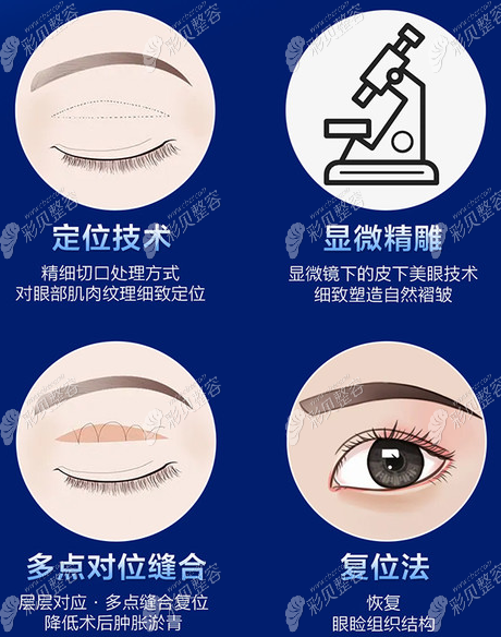 推荐云南铜雀台做全切双眼皮有名的医生及手术大概多少钱