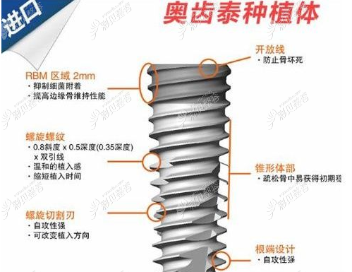 韩国奥齿泰种植体